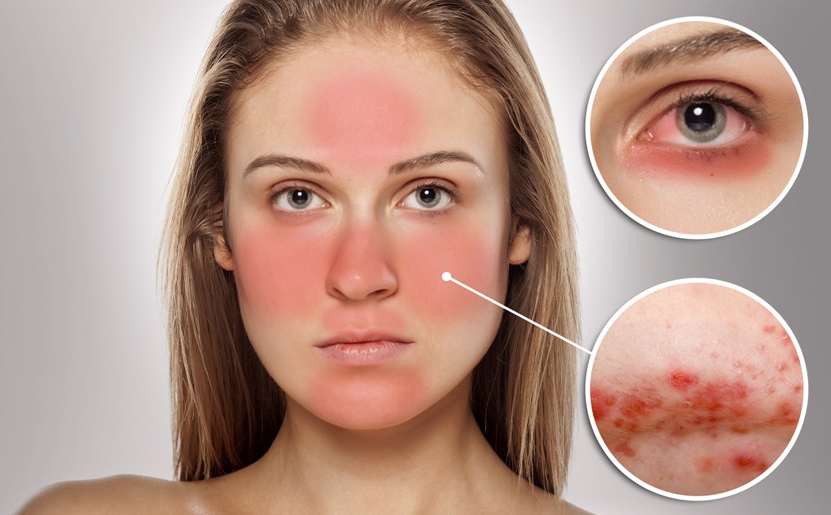 các bước chăm sóc da cơ bản
